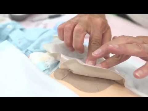 Thay và xả túi hậu môn tạm đại tràng 